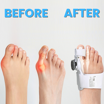 Bunion Corrector